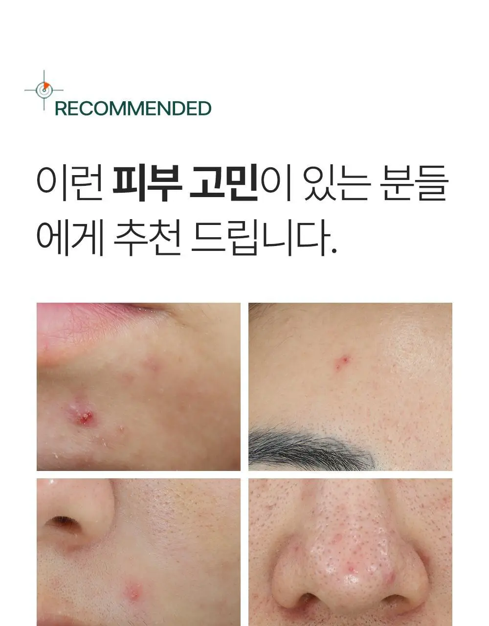 [트러블부위 진정케어] 피캄 센텔라 트러블 스팟 15ml 상세페이지 32